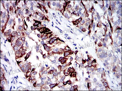 Anti-KRT5 Antibody (R3D38)