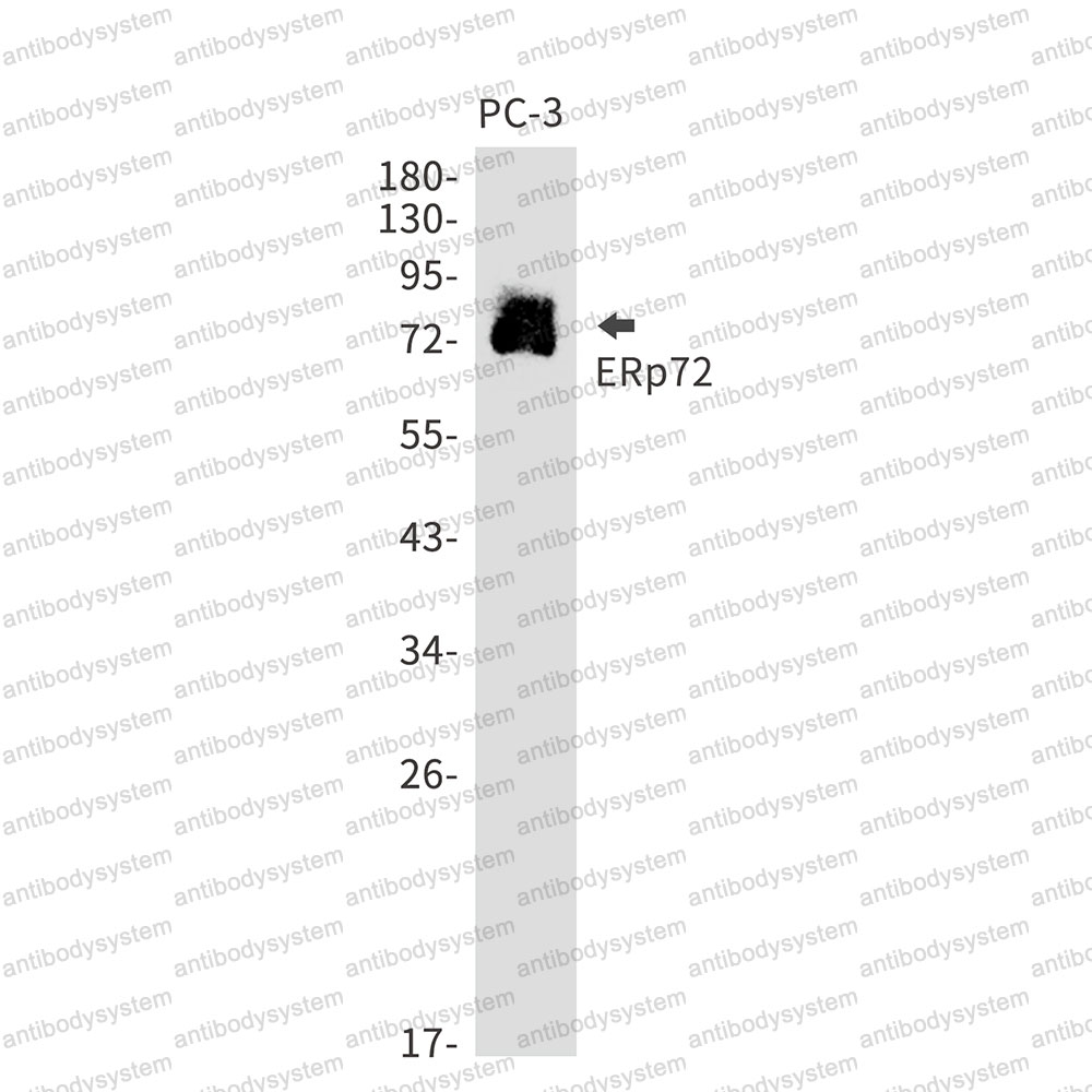 Anti-PDIA4 Antibody (R1P02)