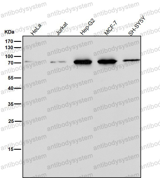Anti-PDIA4 Antibody (R1P01)