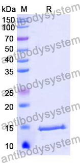 Anti-Human C6/Complement C6 Nanobody (SAA1039)