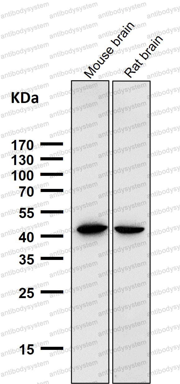 Anti-ACP5 Antibody (R1P03)