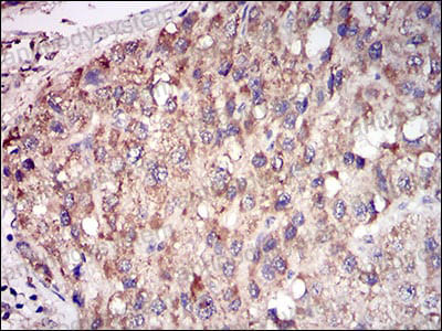 Anti-ACP5 Antibody (R3D42)