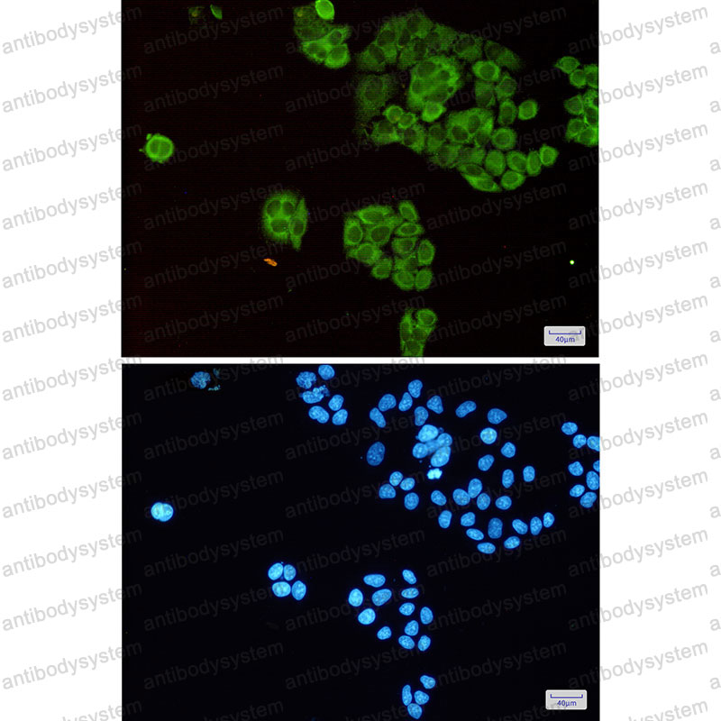 Anti-TPT1 Antibody (R1P05)