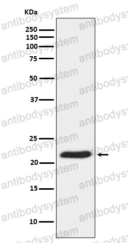 Anti-TPT1 Antibody (R1P04)