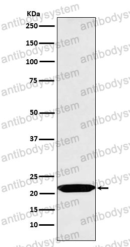 Anti-OSM/Oncostatin-M Antibody (R1P06)