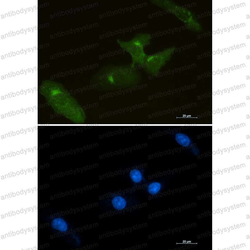 Anti-CD142/F3/TF Antibody (R1P09)