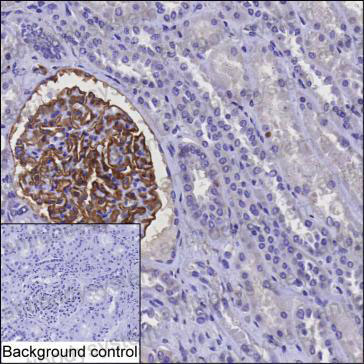 Anti-CD142/F3/TF Antibody (R3D45)