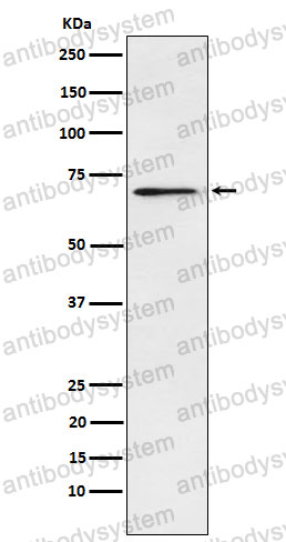 Anti-LCP1 Antibody (R1P11)