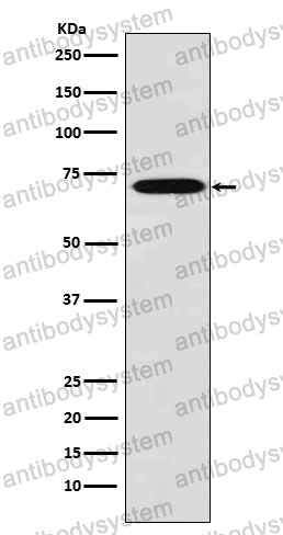 Anti-LCP1 Antibody (R1P10)
