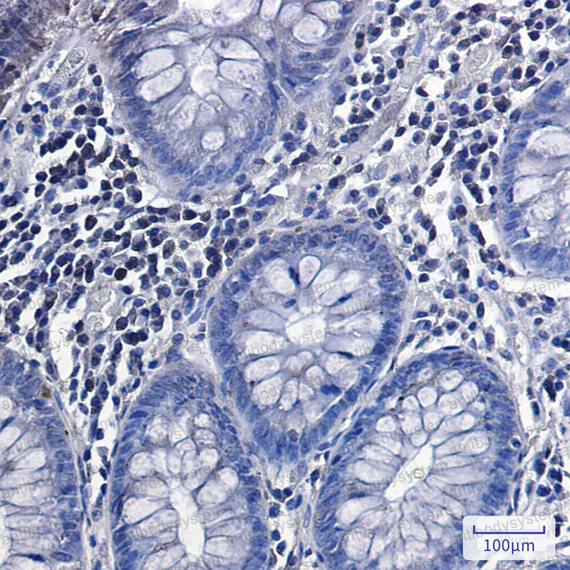 Anti-Phospho-GYS1 (Ser641) Antibody (R1P13)