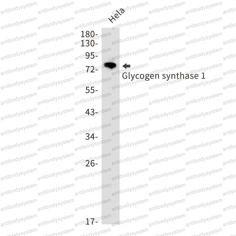 Anti-GYS1 Antibody (R1P14)