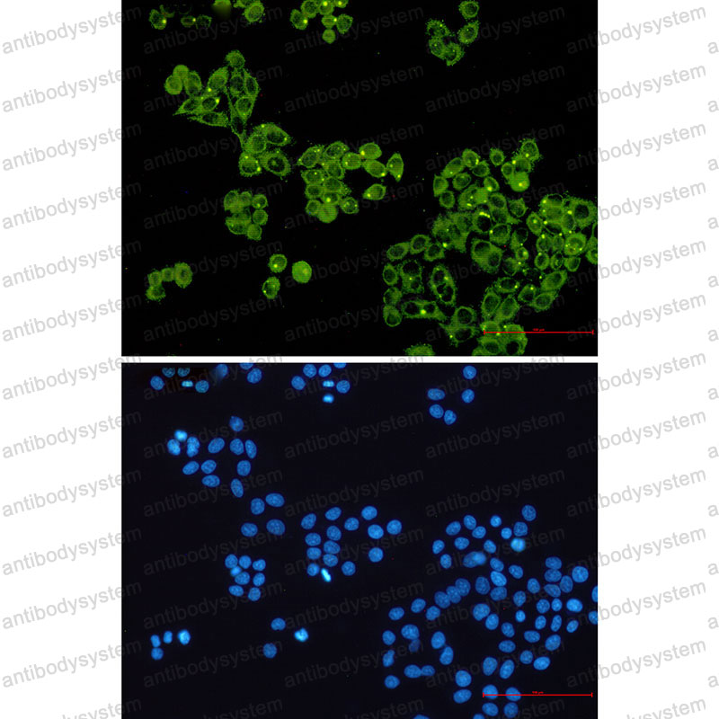 Anti-GYS1 Antibody (R1P15)