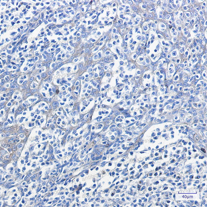 Anti-Phospho-PRKAR2A (Ser99) Antibody (R1P17)