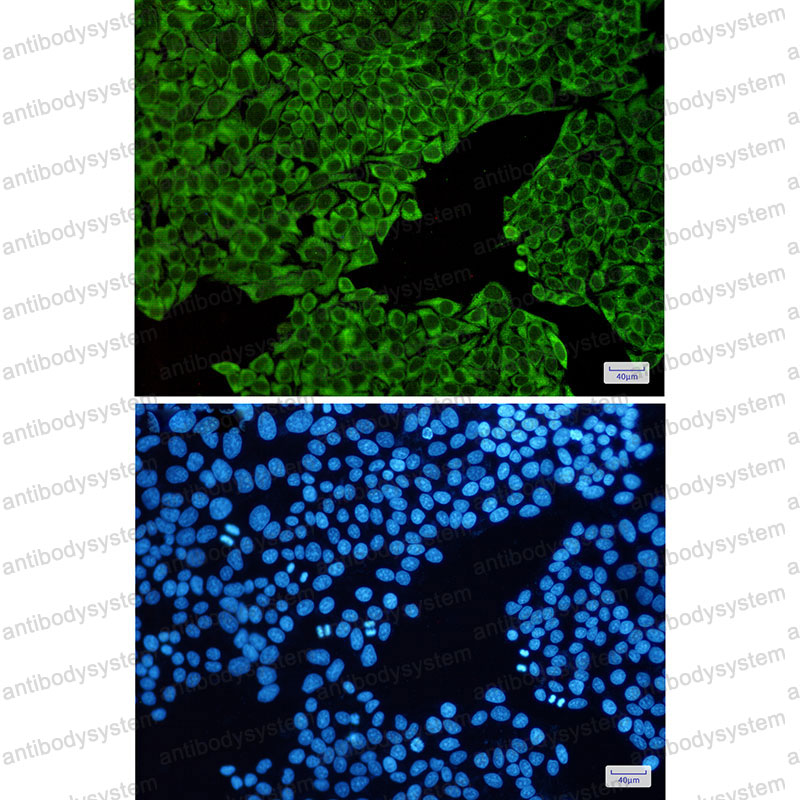 Anti-ENO3 Antibody (R1P18)