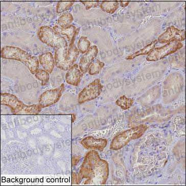 Anti-MTHFD2 Antibody (R3D50)