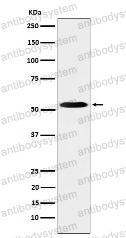 Anti-PRKAR2A Antibody (R1P16)