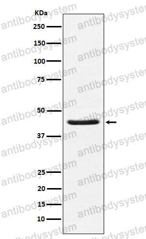 Anti-HSD3B1 Antibody (R1P20)
