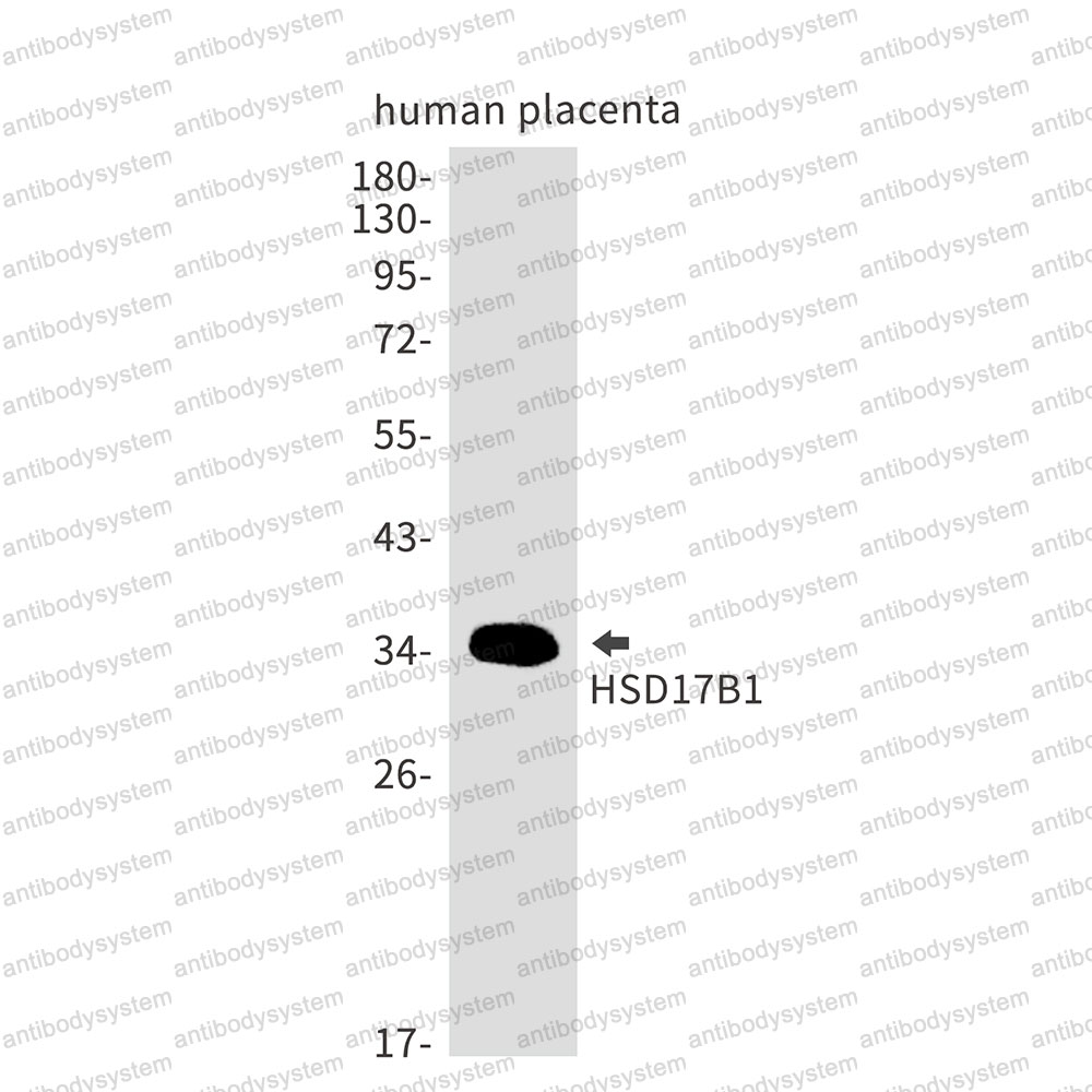 Anti-HSD17B1 Antibody (R1P21)
