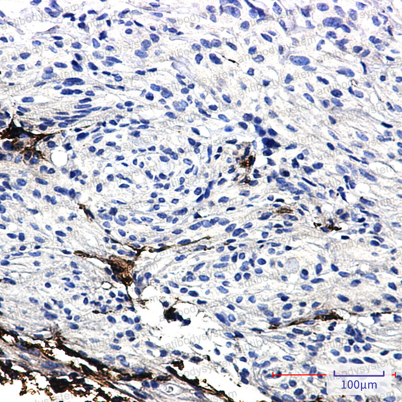 Anti-GFAP Antibody (R1P23)