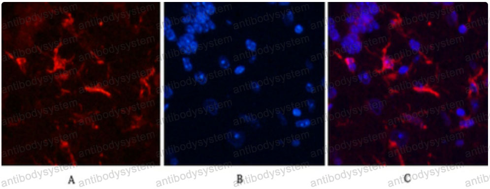 Anti-GFAP Antibody (R3D52)