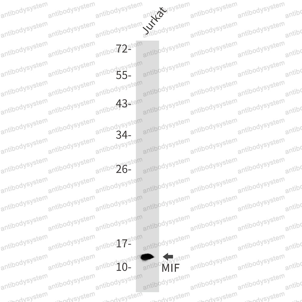 Anti-MIF/GIF Antibody (R1P25)
