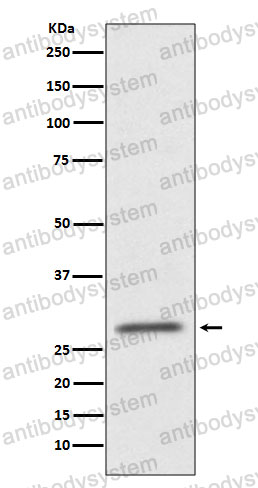 Anti-CD99 Antibody (R1P26)