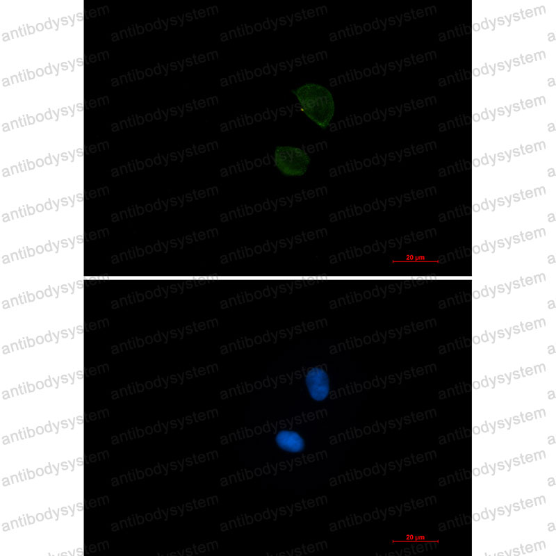 Anti-CD99 Antibody (R1P28)