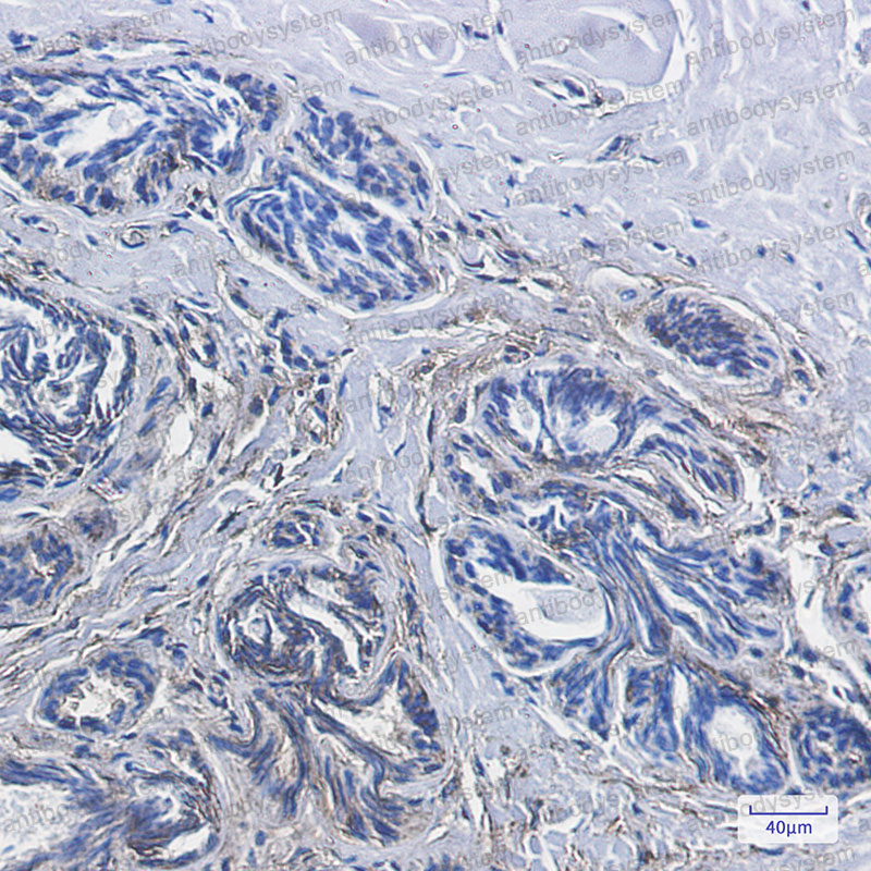 Anti-CD99 Antibody (R1P27)