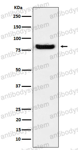 Anti-PRKCSH Antibody (R1P29)