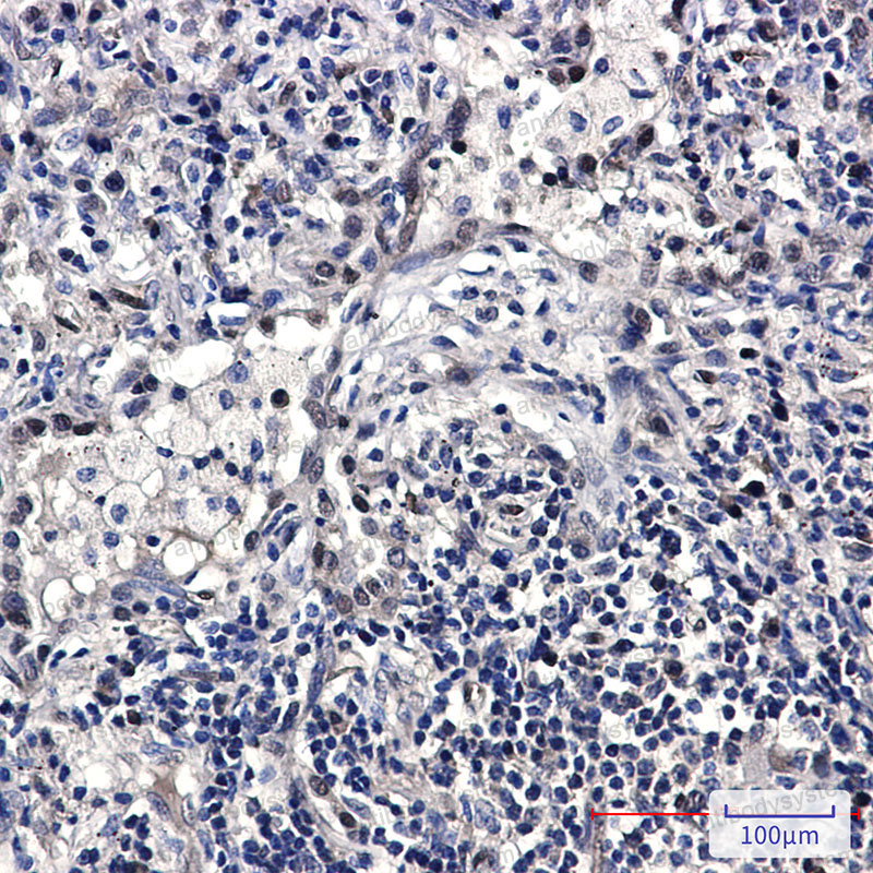 Anti-FDPS Antibody (R1P32)
