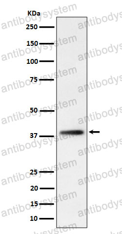 Anti-FDPS Antibody (R1P31)