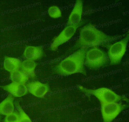 Anti-PKM Antibody (R3D59)