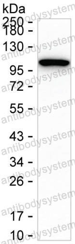 Anti-HSP90B1/GRP94 Antibody (R3D60)