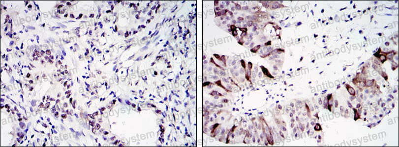 Anti-CCNB1 Antibody (R3D61)