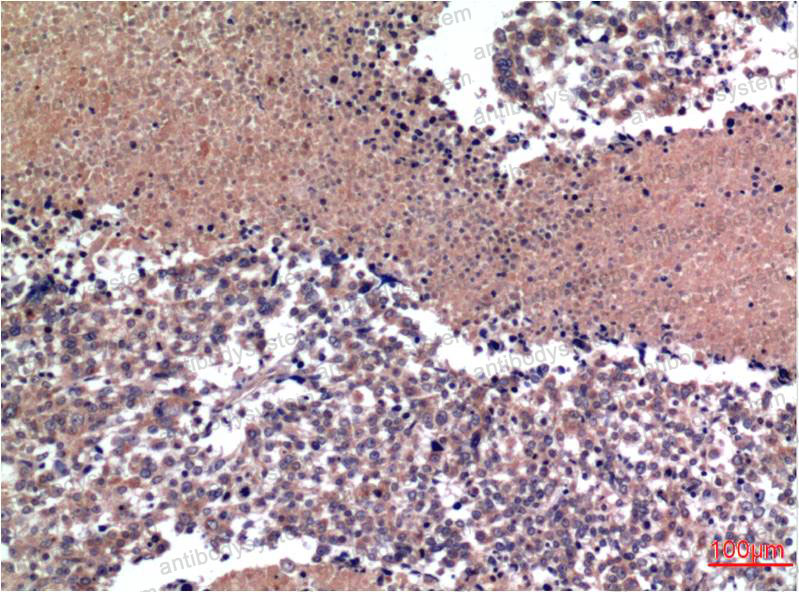 Anti-CCNB1 Antibody (R3D63)