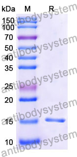 Anti-Human CD122/IL2RB Nanobody (SAA1051)