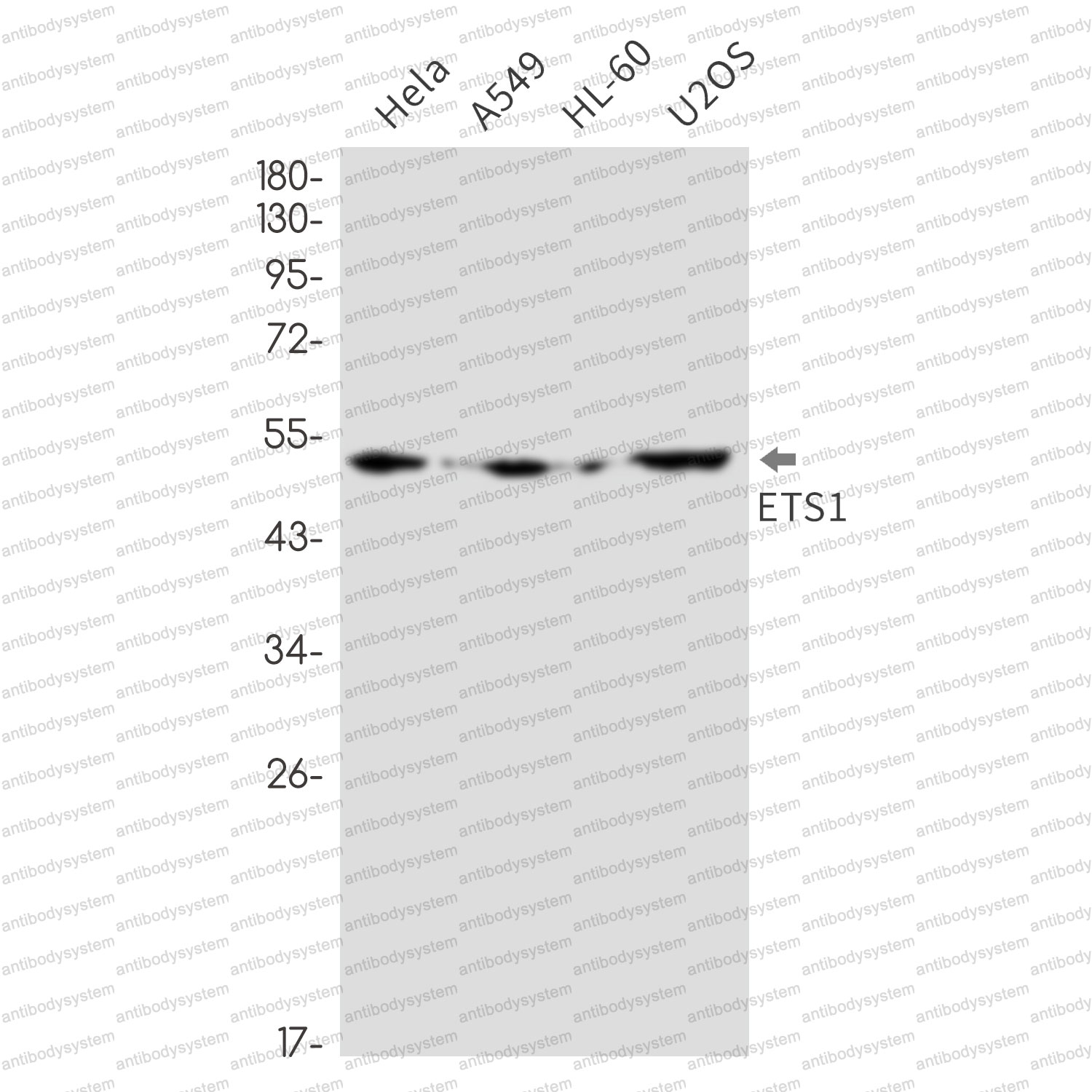 Anti-ETS1 Antibody (R1P54)