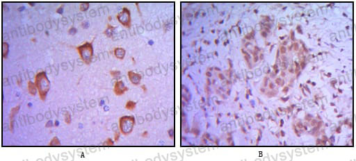 Anti-ETS1 Antibody (R3D75)