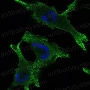 Anti-JUP Antibody (R3D76)