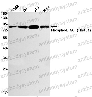 Anti-Phospho-BRAF/B-Raf (Thr401) Antibody (R1P57)