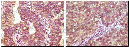 Anti-BRAF/B-Raf Antibody (R3D78)