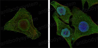 Anti-BRAF/B-Raf Antibody (R3D79)