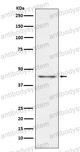 Anti-CPA1/A2/B Antibody (R1P58)