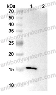 Anti-Human FABP4/aP2 Antibody (CA33)