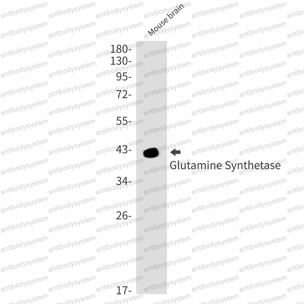 Anti-GLUL Antibody (R1P59)