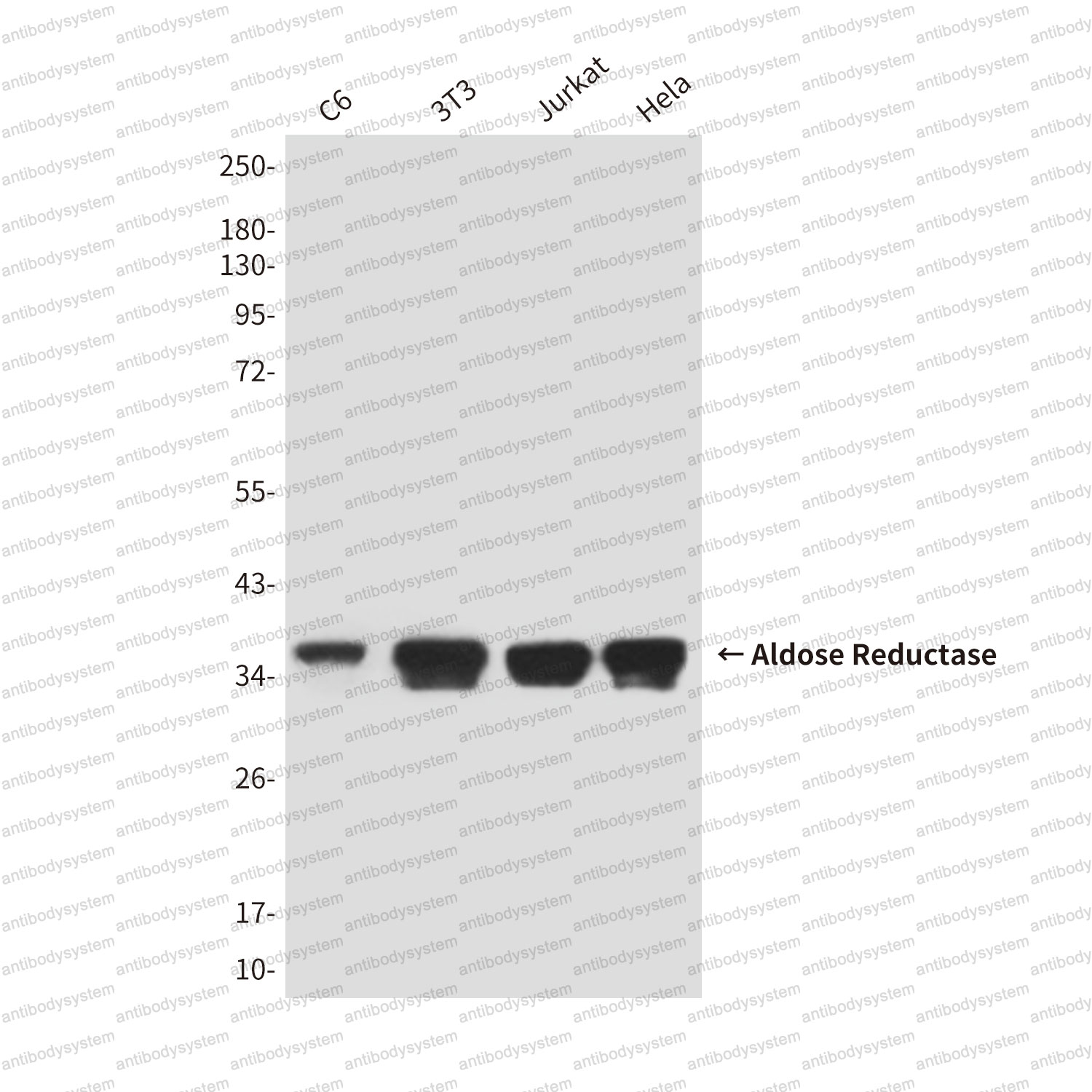 Anti-AKR1B1 Antibody (R3D86)