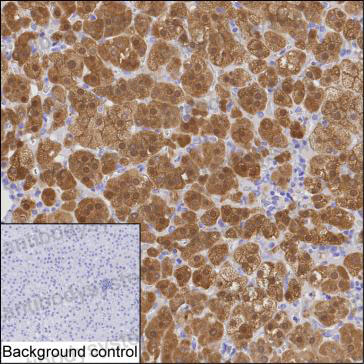 Anti-AKR1B1 Antibody (R3D85)