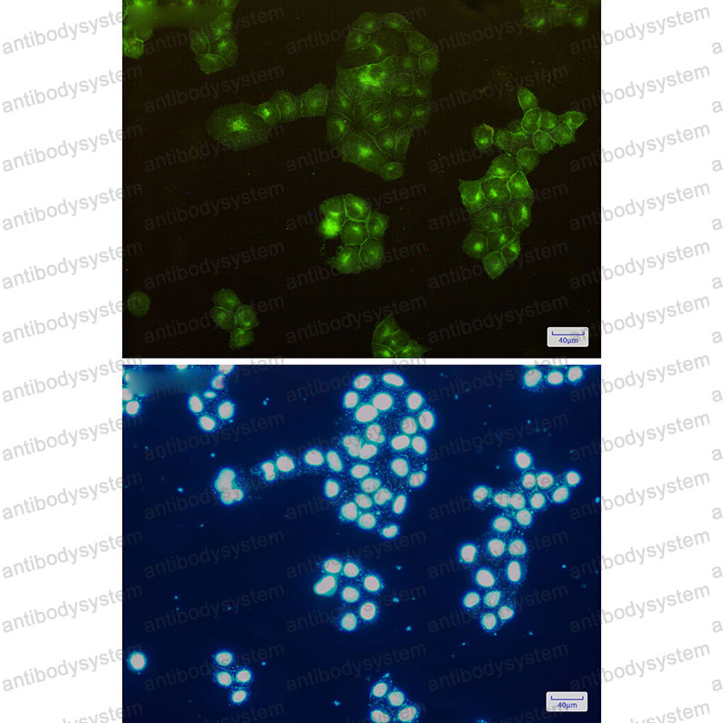 Anti-CD13/ANPEP/APN Antibody (R1P60)