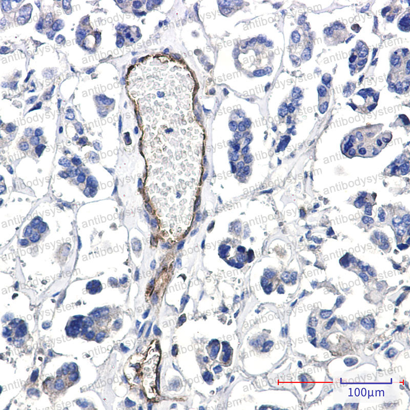 Anti-CD155/PVR Antibody (R1P61)