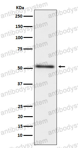 Western blot for Anti-ACP3 Antibody (R1P66) ?>
